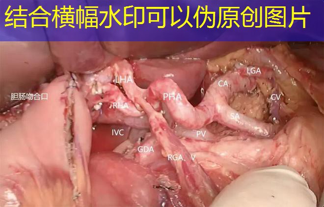 reclame aqui luva bet